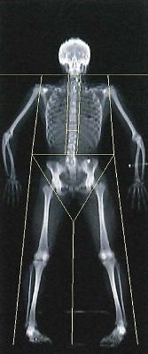 A dual-energy X-ray absorptiometry scan, which shows a participant's skeleton, is shown in the Human Performance Lab at the University of Idaho.